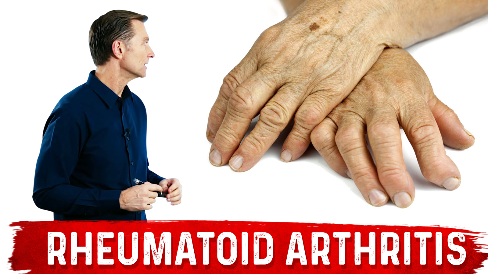 Spices And Herbs For Rheumatoid Arthritis Healthy Keto Dr Berg