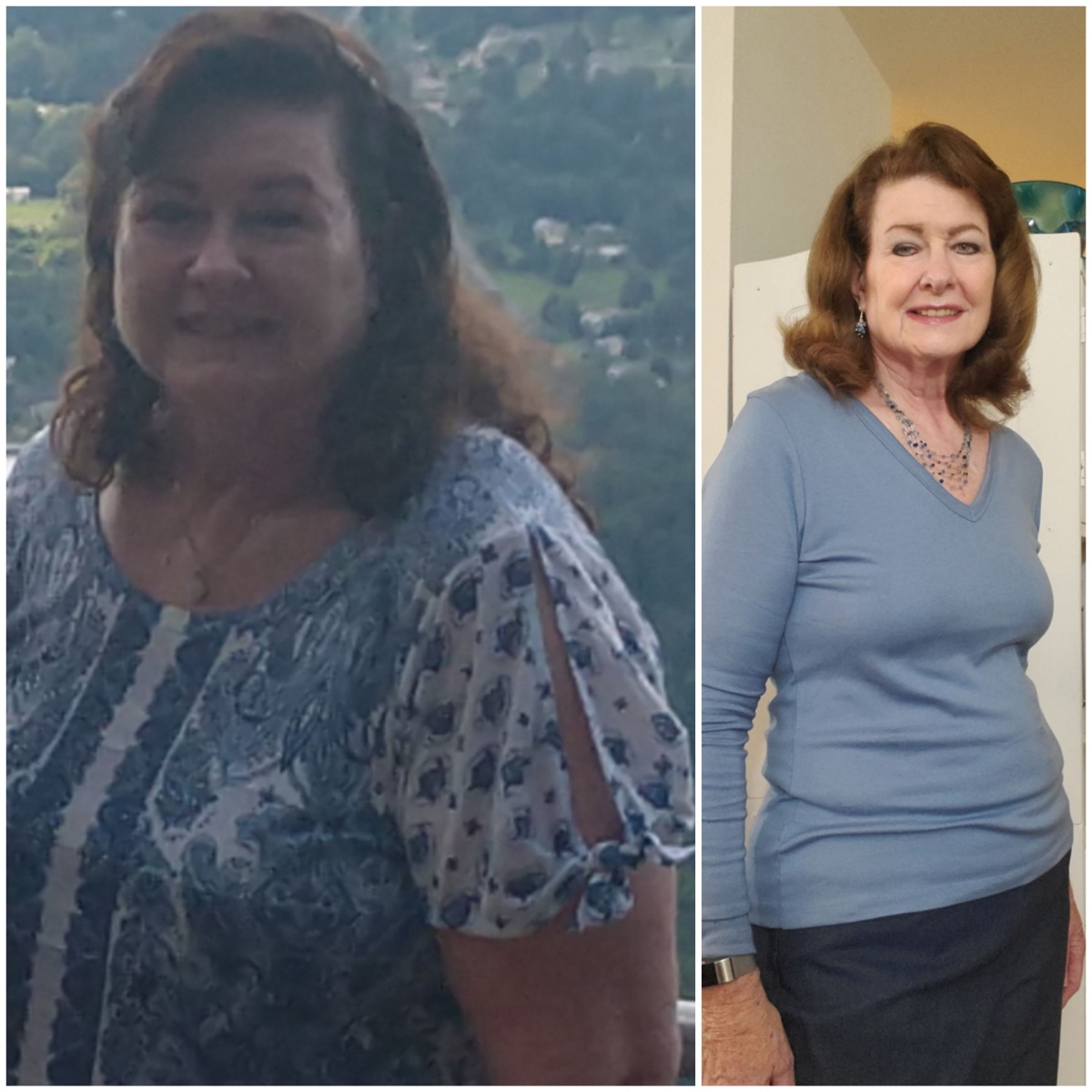 Weight-loss at 70