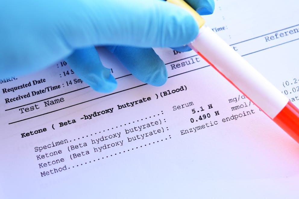 Blood ketone test