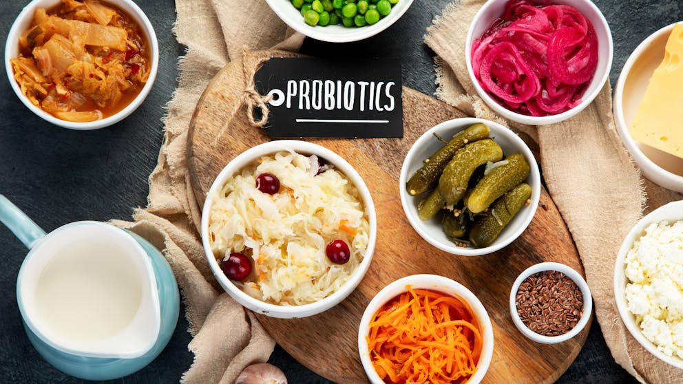 different types of probiotic foods