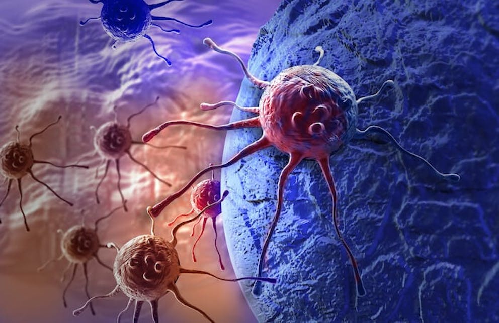 Illustration of cancer and tumor growth | 12 Amazing Benefits of Selenium