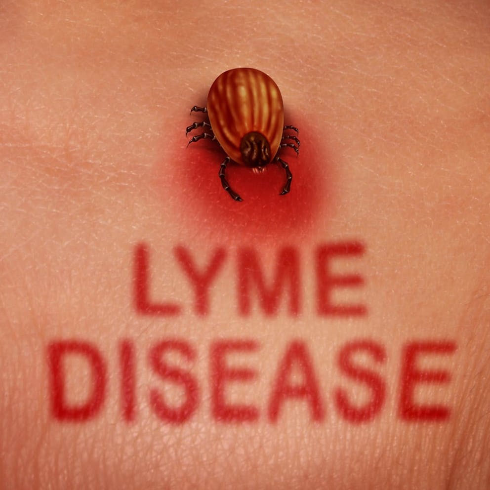 Illustration of tick burrowing into skin with text Lyme Disease in red, Borrelia burgdorferi.
