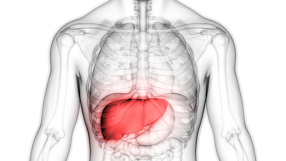 Fatty Liver | Can Keto Cause a Fatty Liver