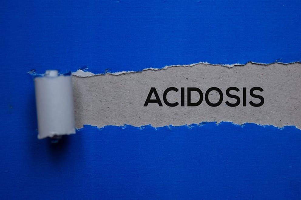 Acidosis text written on torn paper, blue background. Metabolic acidosis concept.