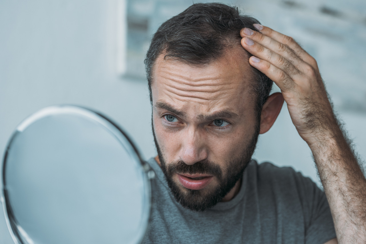 A middle-aged man with hair loss looks in the mirror and holds his hand to a bald spot on his head