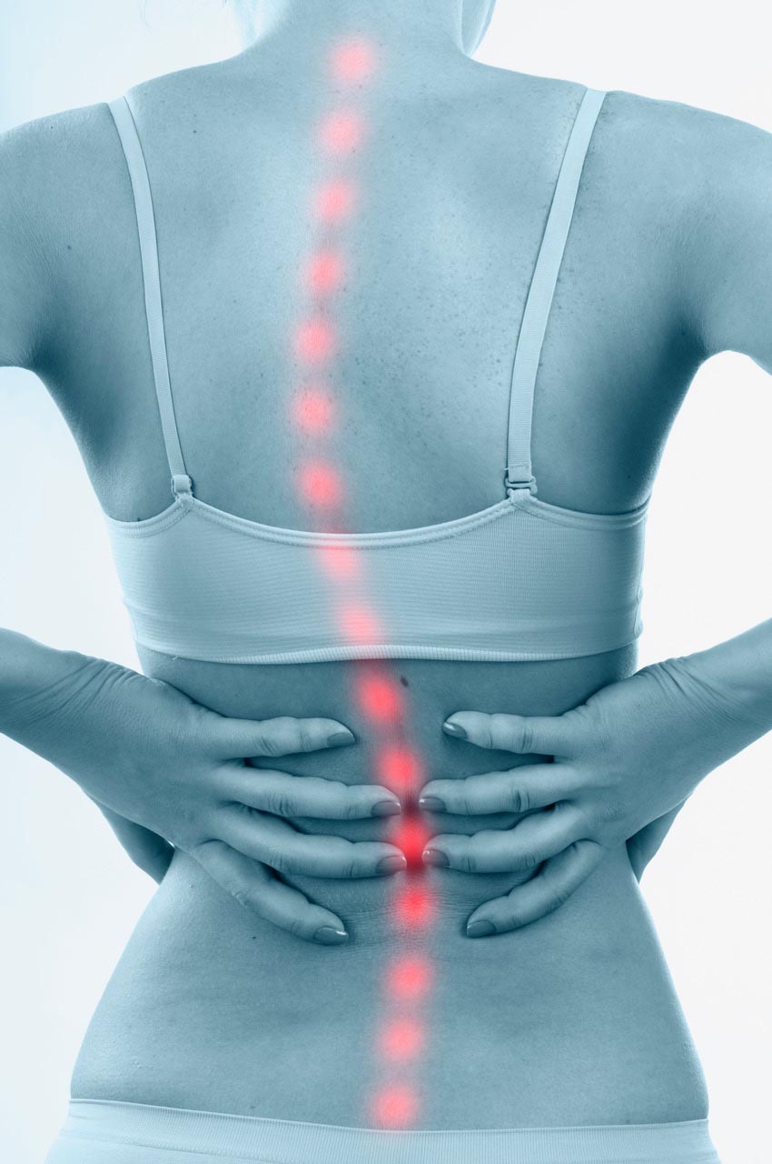 Woman with scoliosis with hands on her back, showing curvature of the spine highlighted in red.