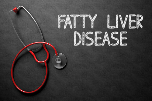 fatty liver disease written on a chalkboard