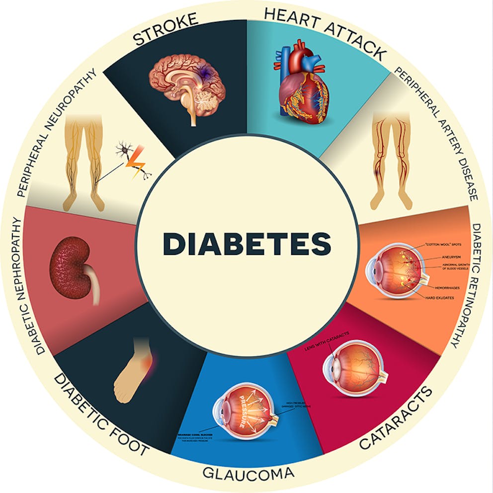 a chart of diabetes complications 