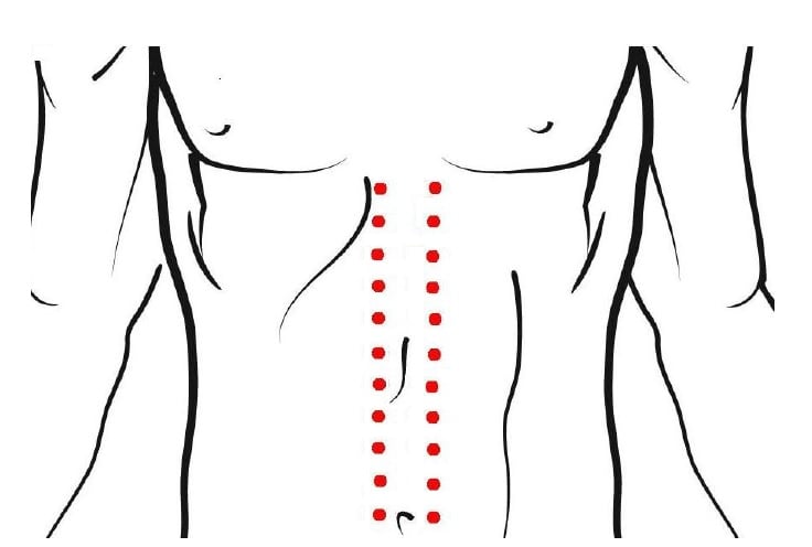 Midline of abdomen