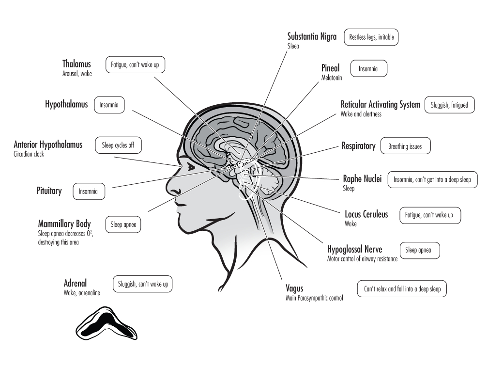 Hypoglossal Pressure Point