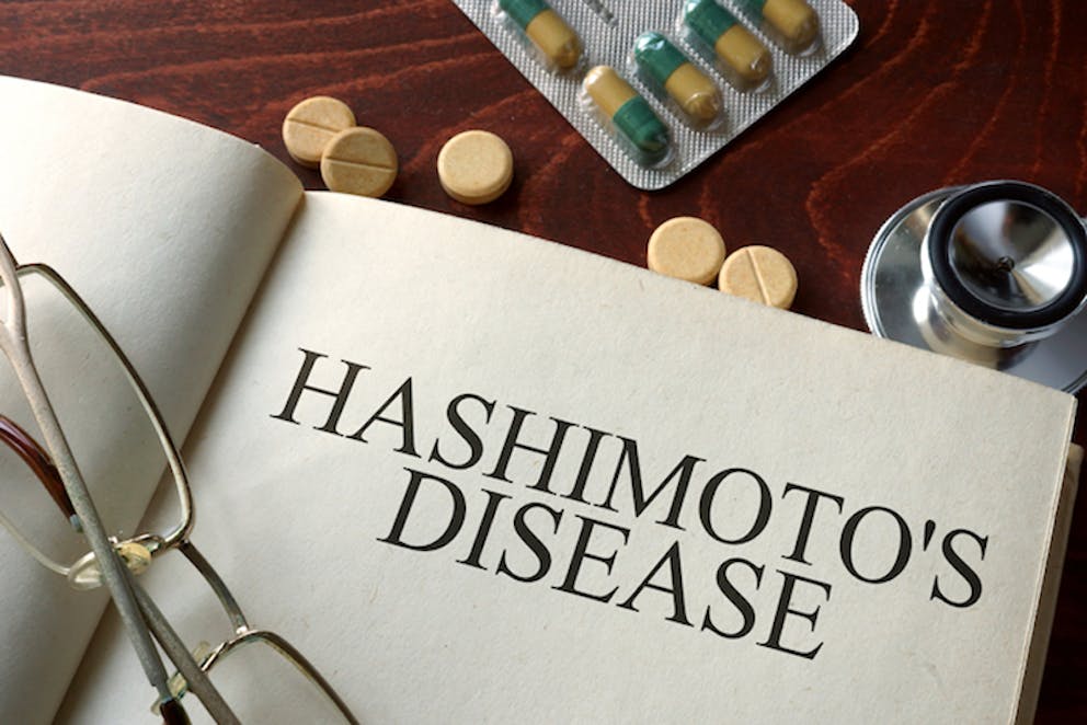 Hashimoto's written in journal laying on a table | Hashimotos and Ketosis