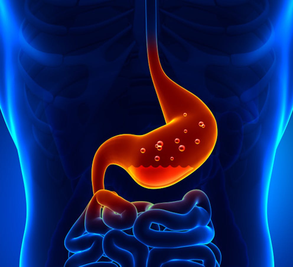 low potassium linked to low hydrochloric acid