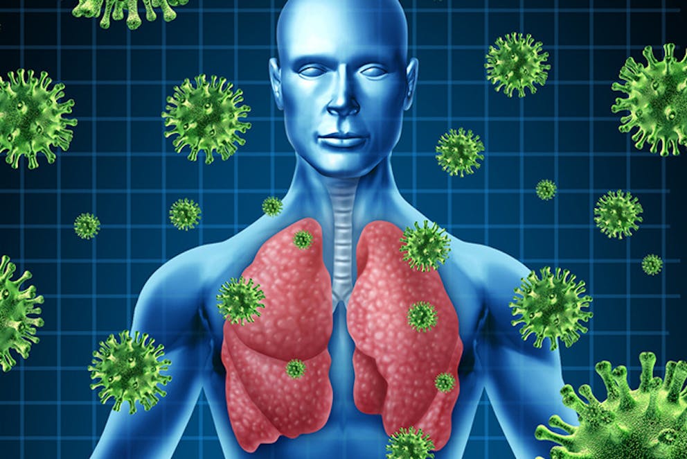 Medical drawing of human lung anatomy on man’s body with viruses around, respiratory infection.