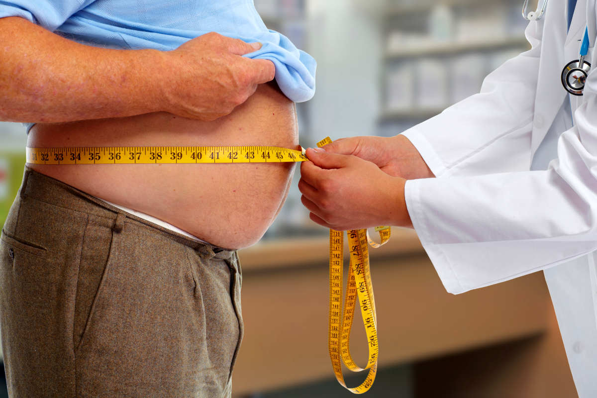 Doctor measuring obese man waist body fat | How To Prevent Sagging Skin As You Lose Weight