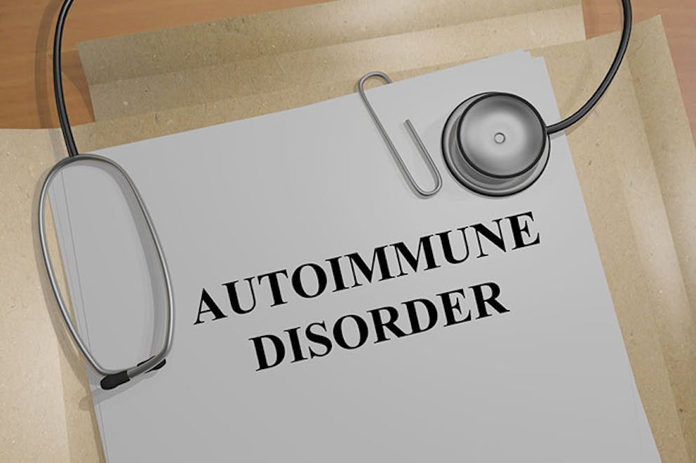 Autoimmune disorder text on piece of paper with paperclip, medical documents and stethoscope.