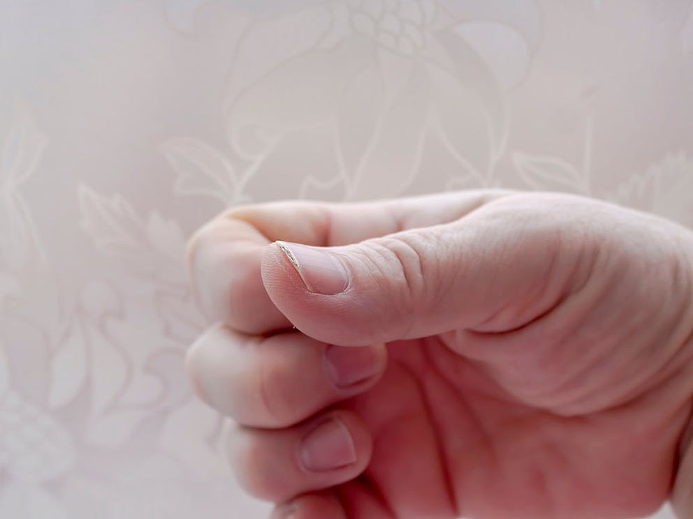 Close-up image of hand looking at fingernail on thumb, fingernail health and symptoms.