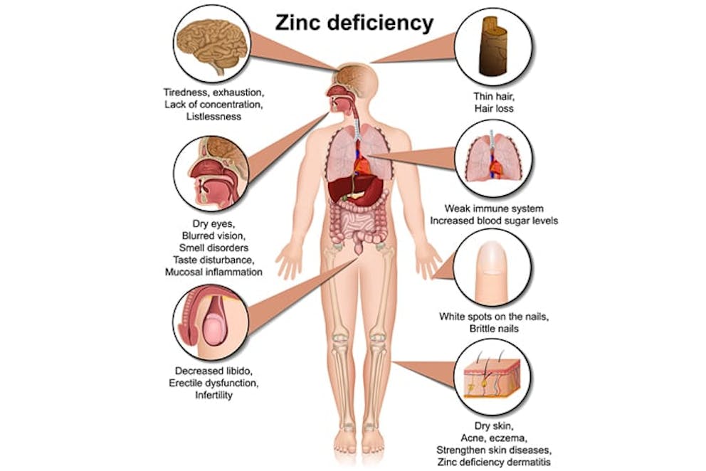 Symptoms of zinc deficiency 