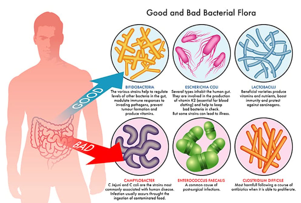 : a chart with common good and bad gut bacteria