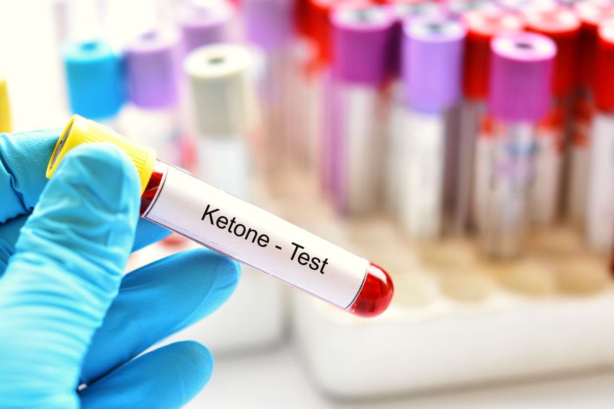 Blood sample tube for ketone test | Understanding The Ketogenic Diet: What Is A Ketone? 