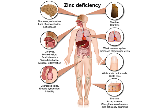 Key Reasons for a Zinc Deficiency