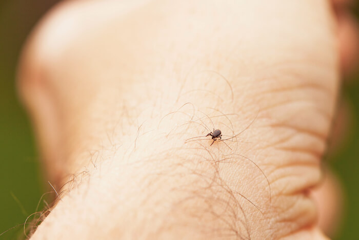 Close up view of a small tick on a person's arm while outdoors | Natural Remedies for Lyme Disease