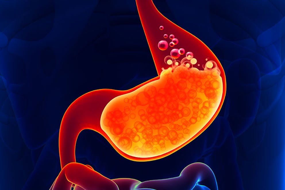 an illustration of stomach acid