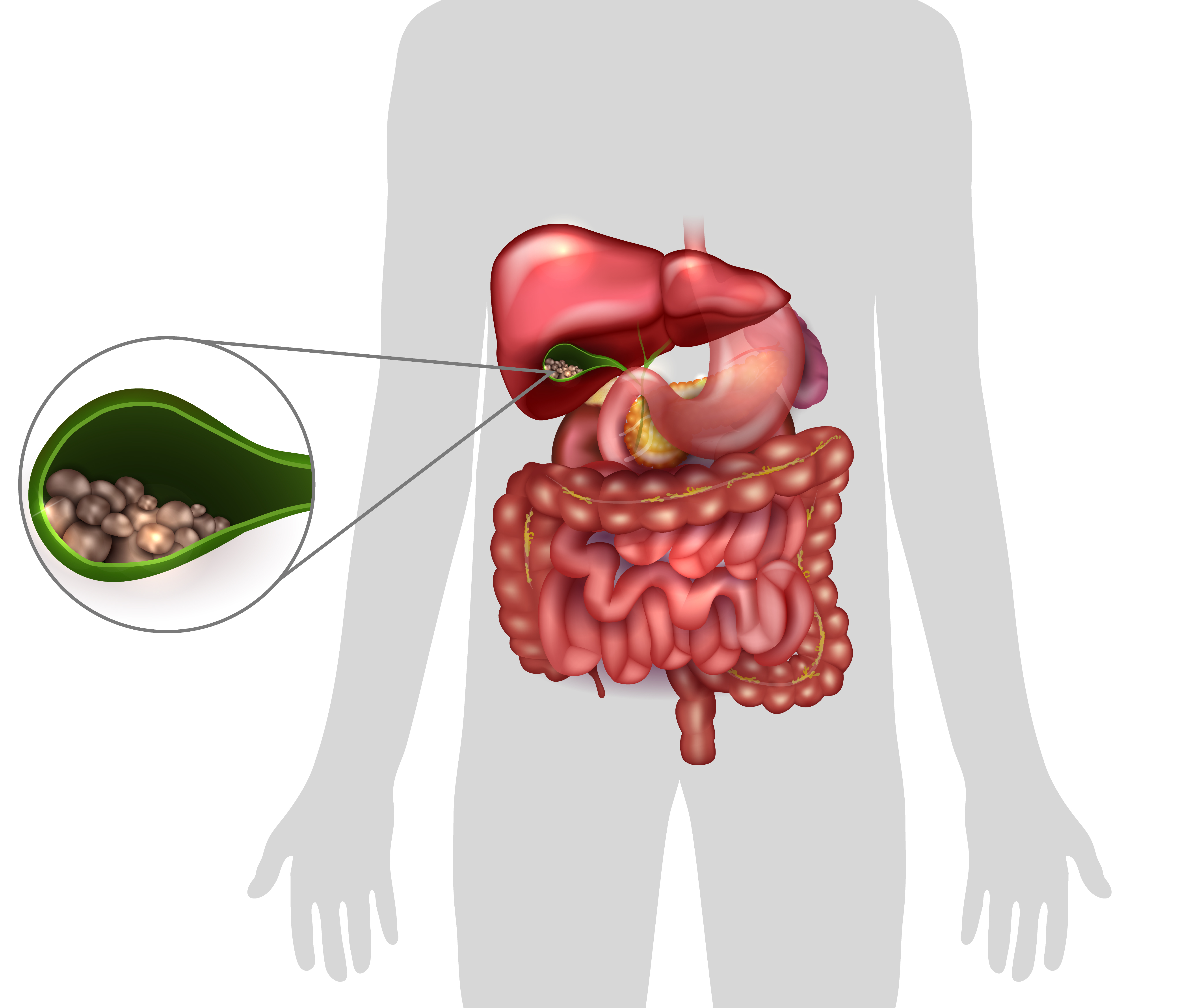 Gallbladder 