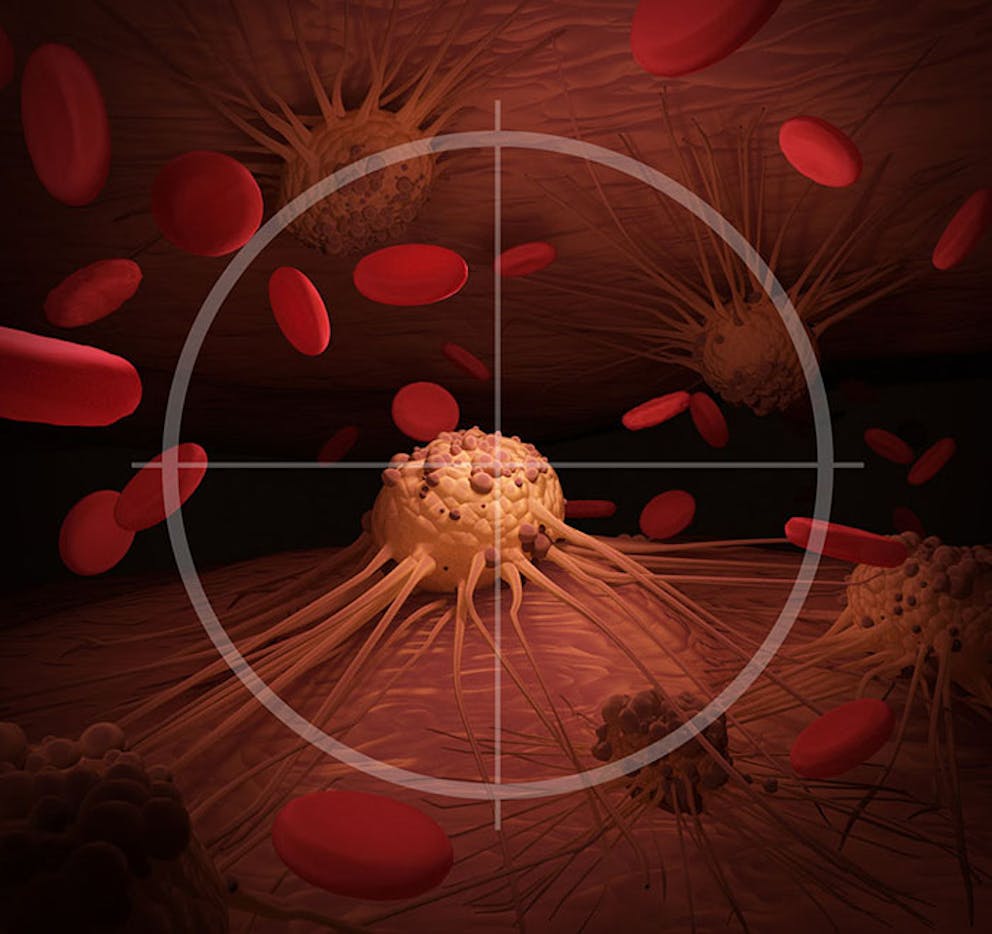 Cancer target with cancer cells and tumor in crosshairs, cancer prevention and treatment.
