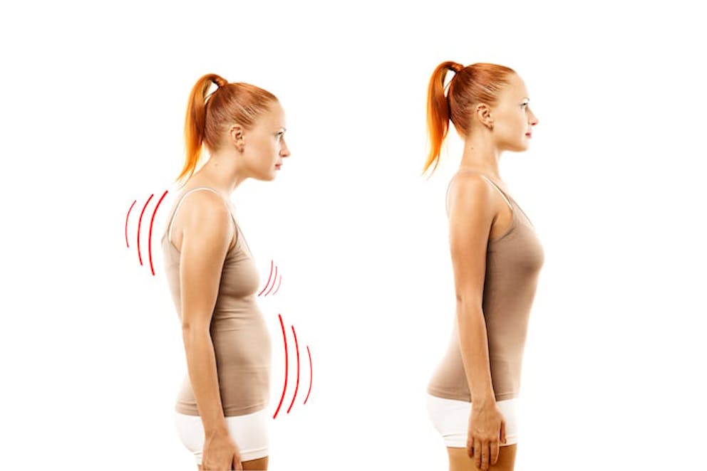 Woman before and after postural exercise | Poor Posture Exercises
