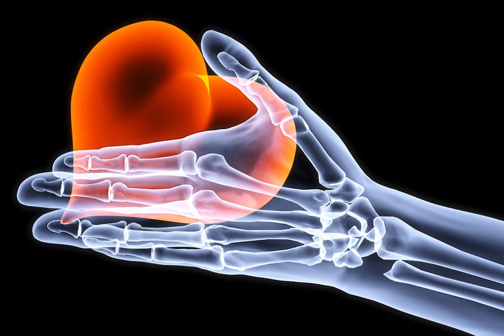 X-ray image of hand bones holding red image of a heart, showing heart and bone health.