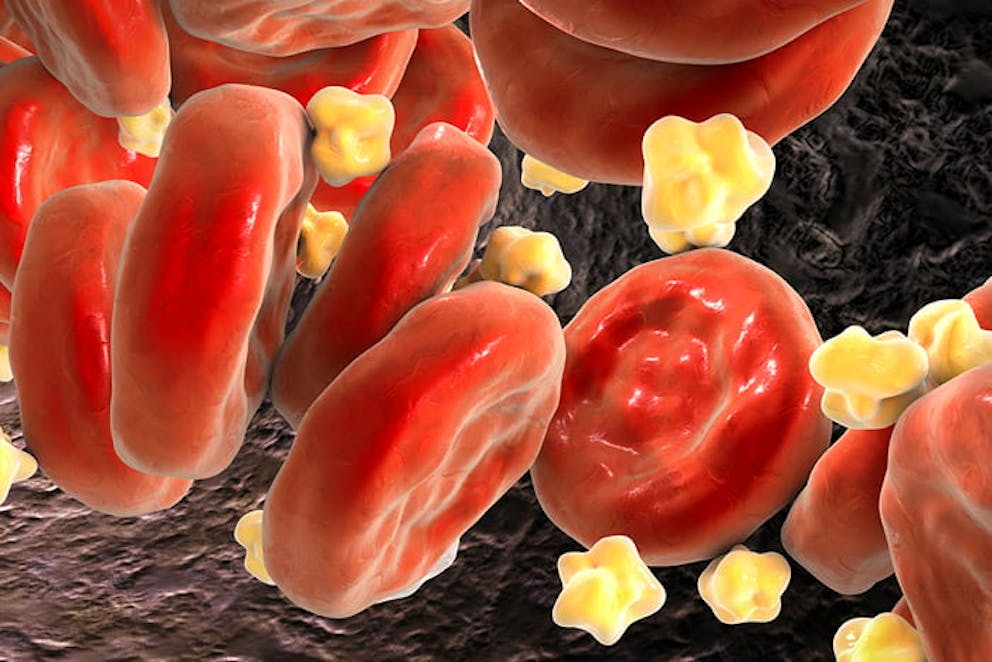 a drawing of cholesterol particles in the blood