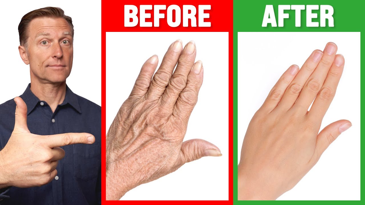 8. How to Make Wrinkled Hands Look Better with Nail Polish - wide 5