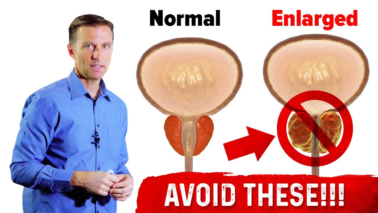 Enlarged Prostate 4 Things to Avoid