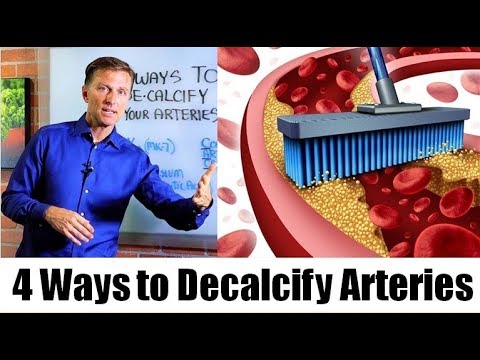 Vitamins & Other Nutrients That Remove Arterial Plaque | Dr. Berg