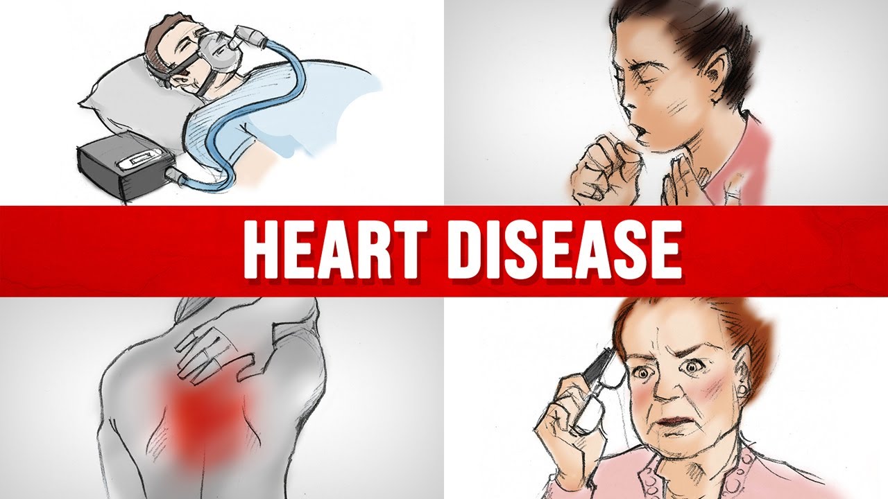 4 surprising signs you may have heart disease