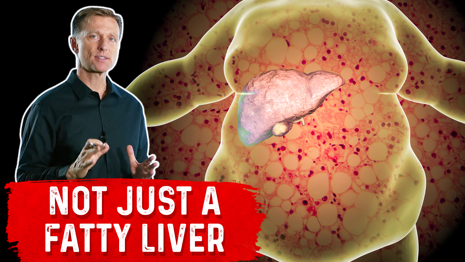 A Fatty Liver Harms All Your Organs | Healthy Keto™ Dr. Berg