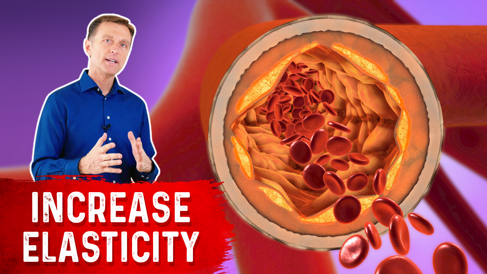 Arterial Stiffness and Vitamin D Healthy Keto™ Dr. Berg