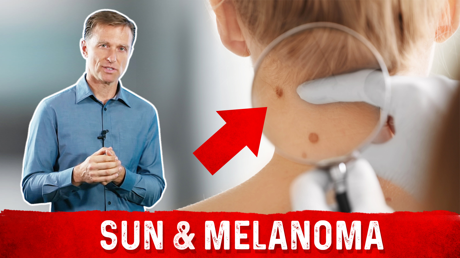 Does the Sun Cause or Prevent Melanomas? Healthy Keto™ Dr. Berg
