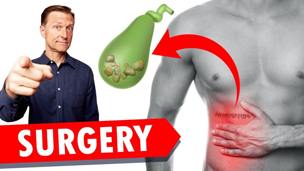 Gallbladder Surgery (Removal) | Healthy Keto™ Dr. Berg