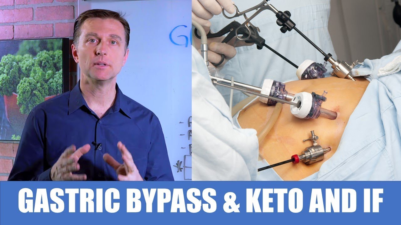 Gastric Bypass Keto and Intermittent Fasting Dr. Berg
