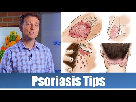 Get Rid of the Cause of Psoriasis Nutritionally | Dr. Berg