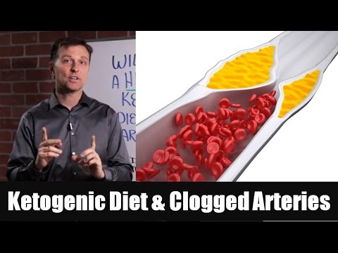 High fat Ketogenic Diet and Clogged Arteries| Dr. Berg