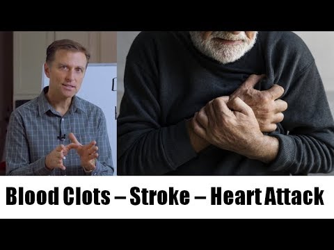 How to dissolve blood clots naturally