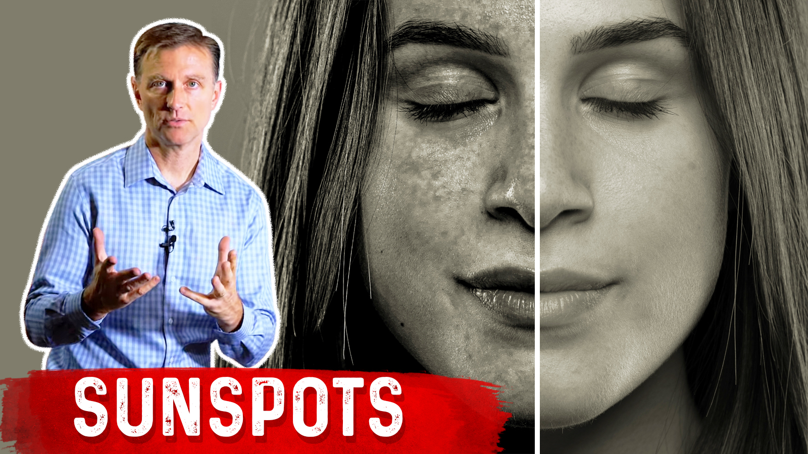 How to Get Rid of Sunspots on Your Skin Healthy Keto™ Dr. Berg