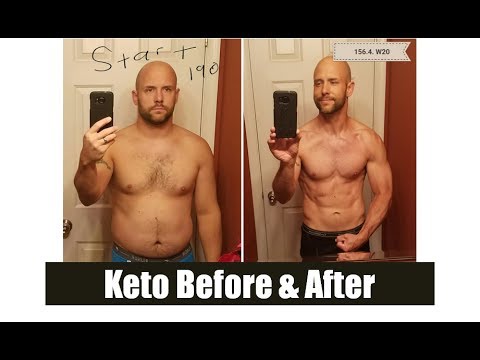 Intermittent Fasting Interview With Dan McGinley | Healthy Keto™ Dr. Berg