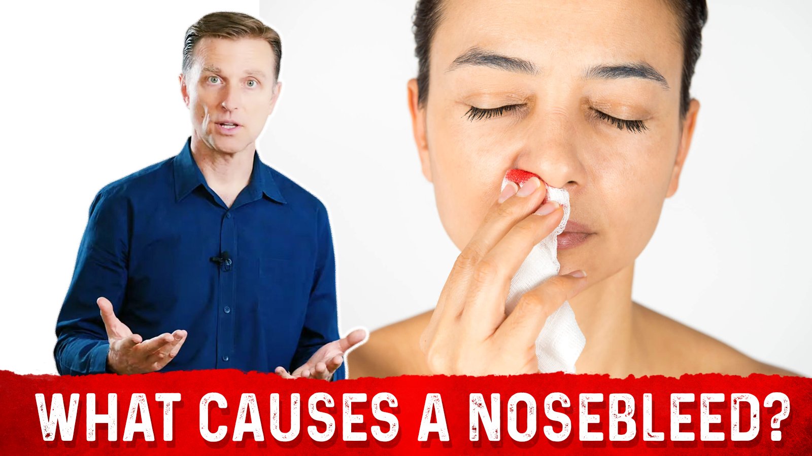 Nosebleeds the Common Causes | Healthy Keto™ Dr. Berg