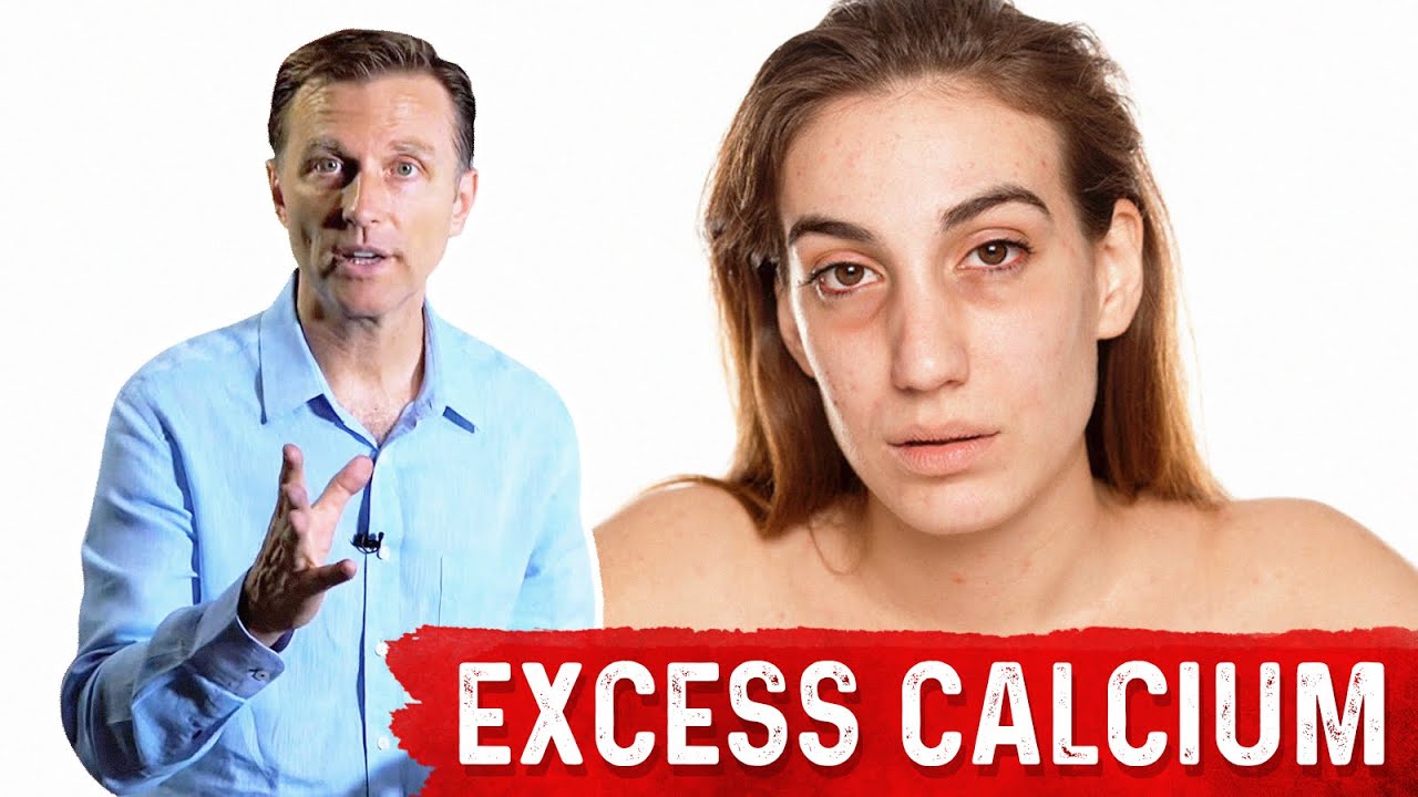 Serious Side Effects from Excess Calcium | Healthy Keto™ Dr. Berg