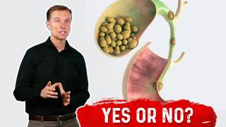 Should You Remove Your Gallbladder Because of a Stone? | Healthy Keto ...