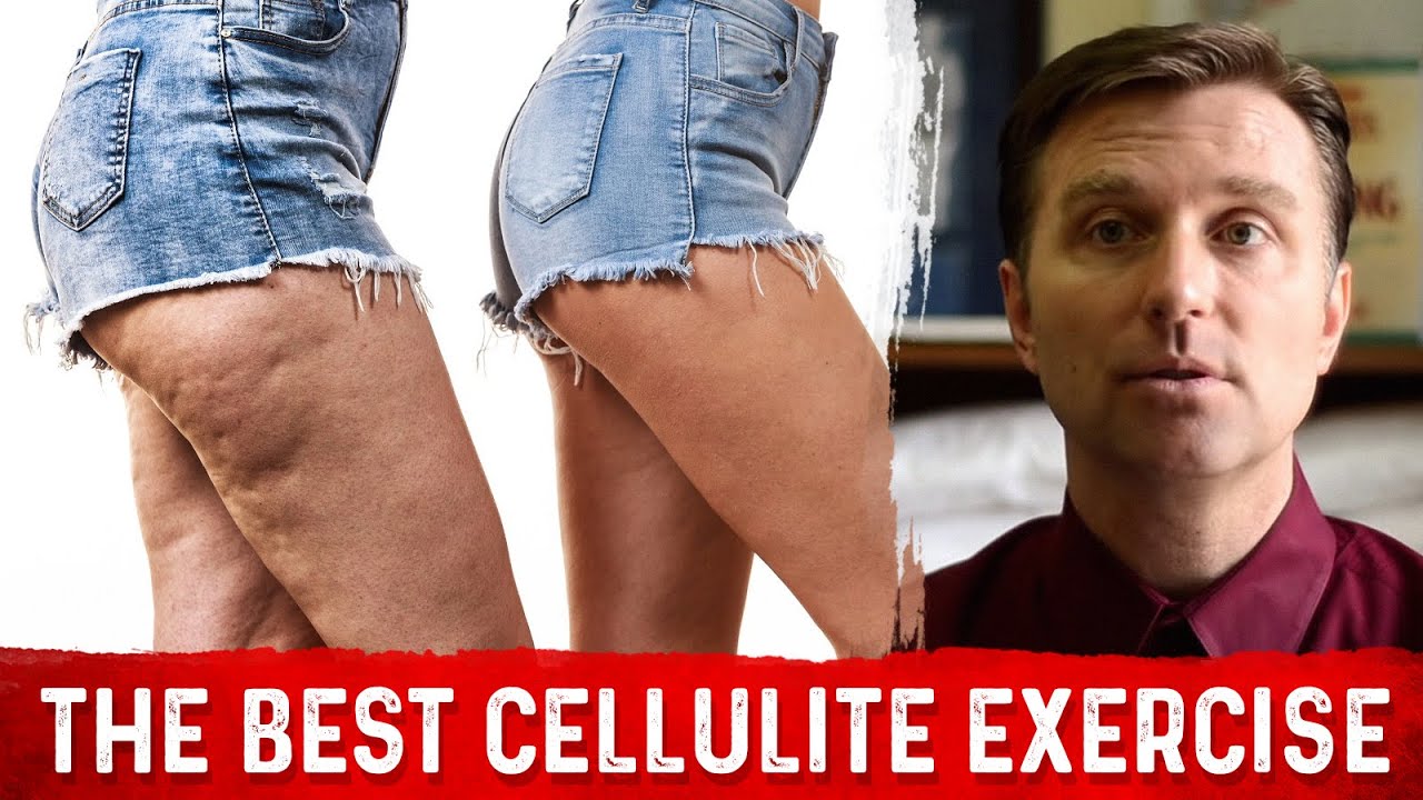 How do I lose the cellulite? : r/personaltraining