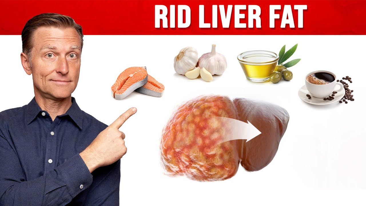 The BEST Foods For A Fatty Liver | Healthy Keto™ Dr. Berg